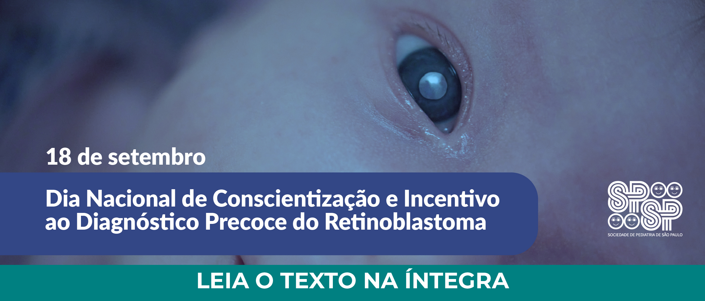 18 de setembro: Dia Nacional de Conscientização e Incentivo ao Diagnóstico Precoce do Retinoblastoma